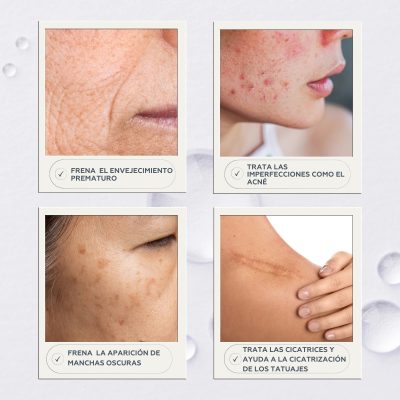 RETIKOS Crema con retinol (0.3%), 50ml